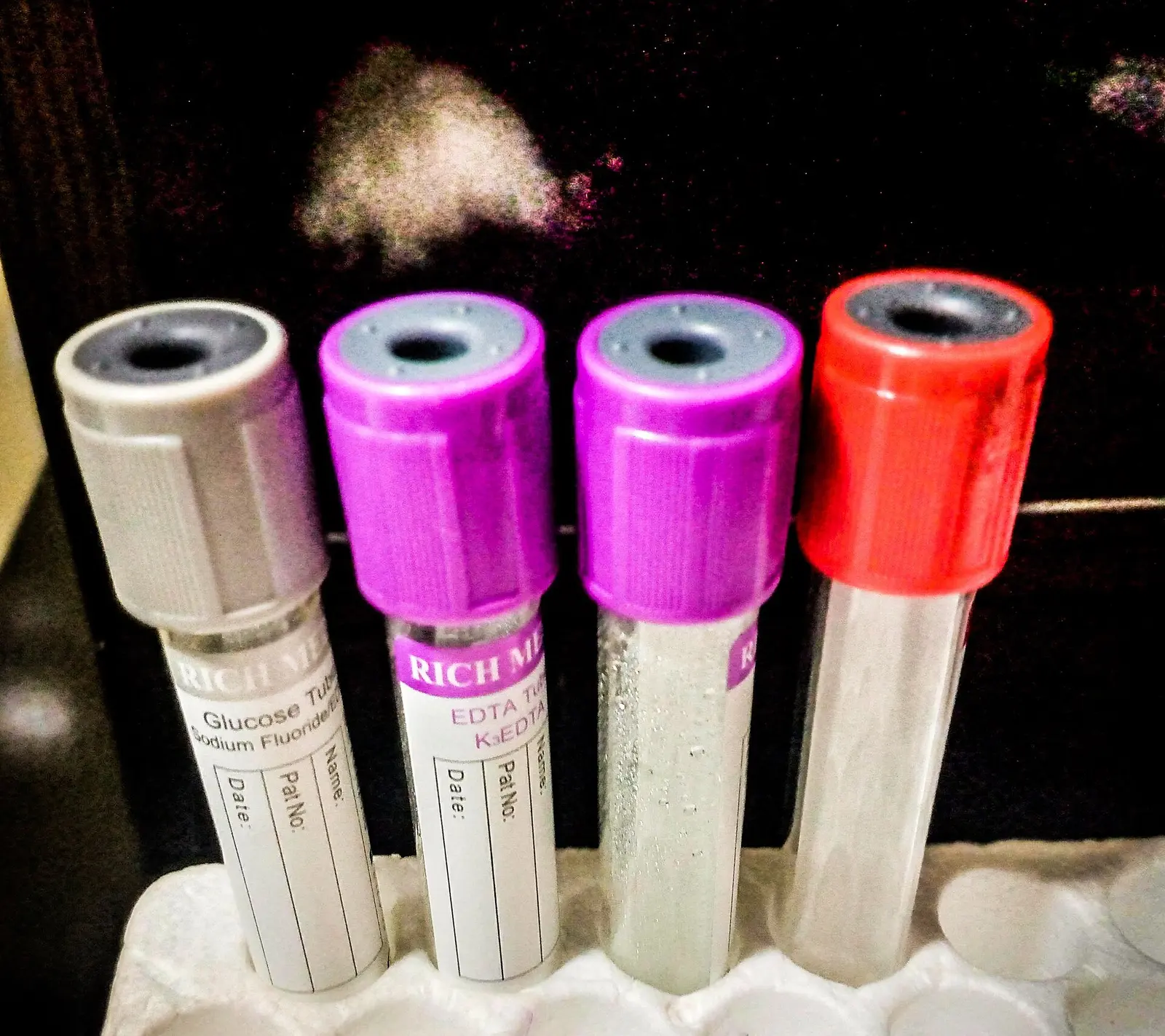Perfil de laboratorio de 12 pruebas — Laboratorio Vital